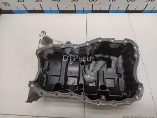 8200535857 Поддон масляный двигателя Renault Logan 1 Арт AM90212015, вид 2
